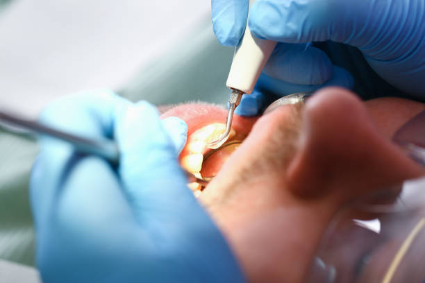 Best Emergency Dental Surgery in Bay City, MI